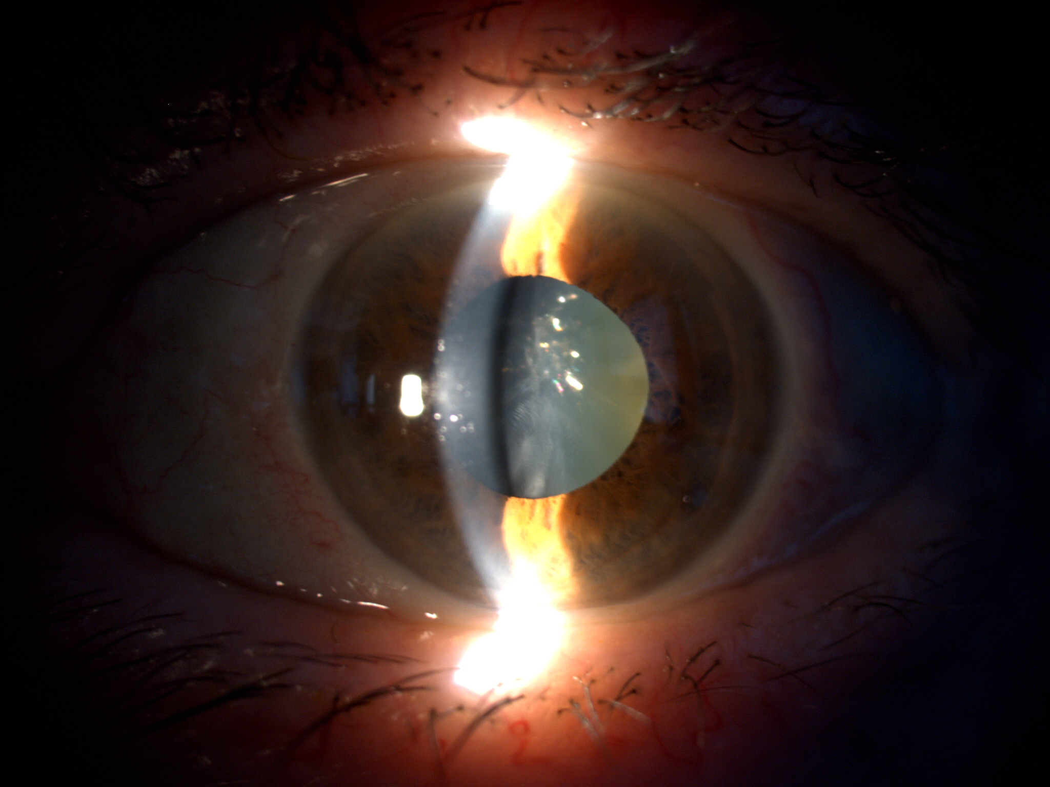 Foto del fundus (retinografia) e del segmento anteriore